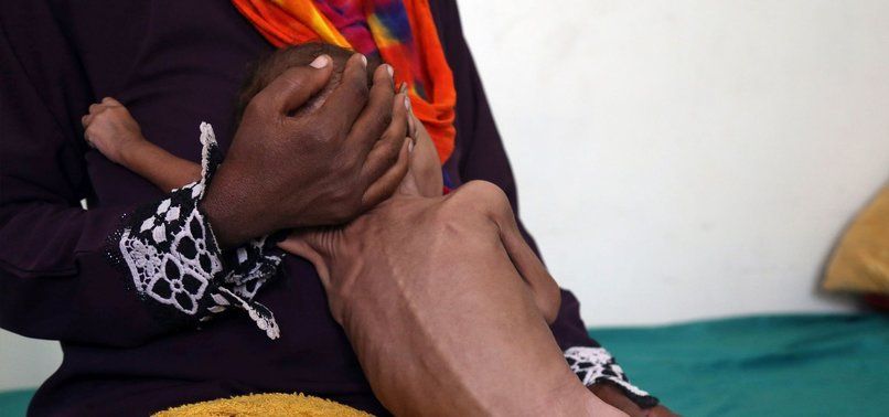 unicef hon 30 tre em the gioi co van de ve dinh duong