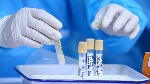 covid19 hai duong phat hien chum ca benh chua ro nguon lay tp lai chau tam dung mot so hoat dong khong thiet yeu