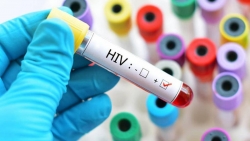 Mỹ phát hiện phương pháp dẫn tới 'cánh cửa' chữa khỏi hoàn toàn HIV