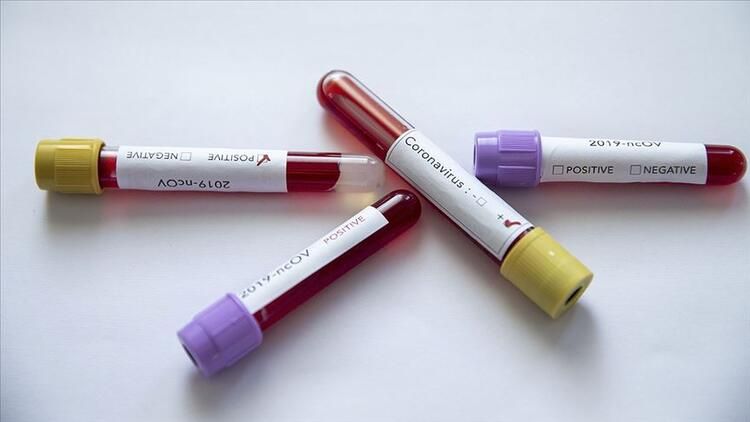 Dịch Covid-19 ở Đông Bắc Á: Trung Quốc ghi nhận thêm 62 ca bệnh, Triều Tiên triển khai xét nghiệm virus dich covid 19 o dong bac a trung quoc ghi nhan them 62 ca benh trieu tien trien khai xet nghiem virus