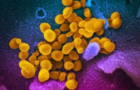 dich covid 19 nga ghi nhan so tu vong moi cao ky luc tokyo bat dau noi long phong toa