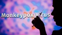 Mỹ: Ít nhất 31 trường hợp mắc bệnh đậu mùa khỉ ở trẻ em, cảnh báo nguy cơ diễn tiến bệnh
