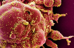 NGUY HIỂM! SARS-CoV-2 chủ đạo hiện nay là biến thể mới, lây lan cực mạnh trong tế bào người