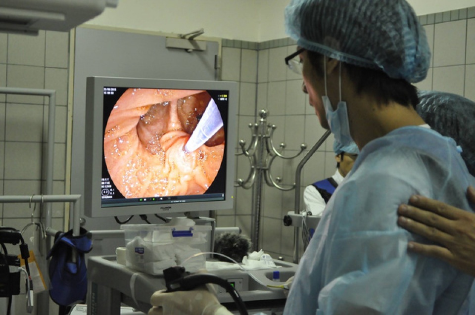 cach nao phat hien som ung thu duong tieu hoa