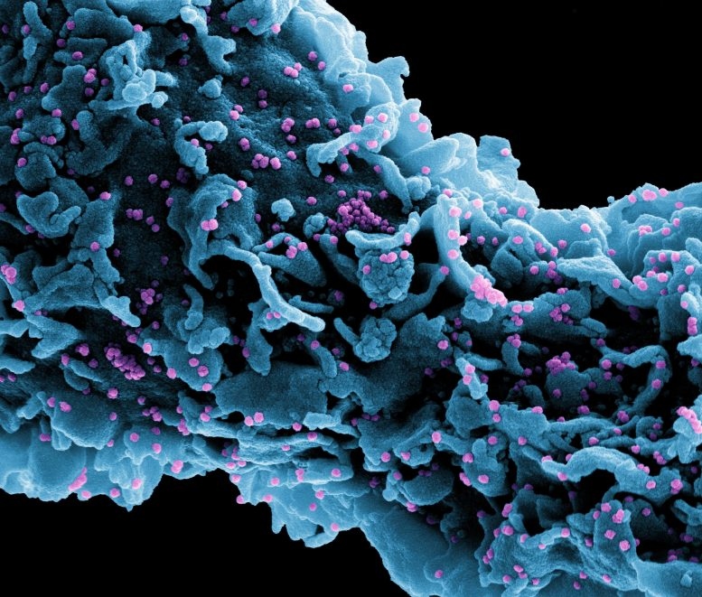 Vaccine Covid-19 tạo ra kháng thể ở những người có miễn dịch yếu. (Nguồn: NIAID)