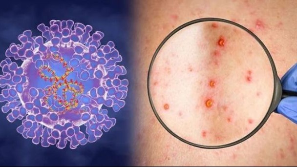 sinh ton trong ky dai dich