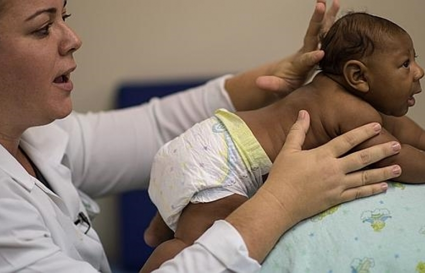 Trẻ bị tật đầu nhỏ gặp nhiều vấn đề trong quá trình phát triển