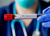 Dịch Covid-19: Angola và Timor Leste ghi nhận ca nhiễm SARS-CoV-2 đầu tiên