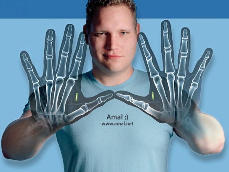 thiet bi cay ghep sinh hoc duoi da