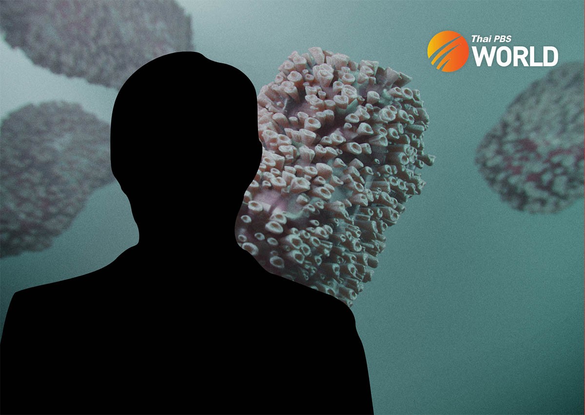 Campuchia: Ca bệnh đậu mùa khỉ đầu tiên là ca nhiễm bỏ trốn từ Thái Lan Campuchia cập nhật thông tin về ca bệnh đậu mùa khỉ đầu tiên