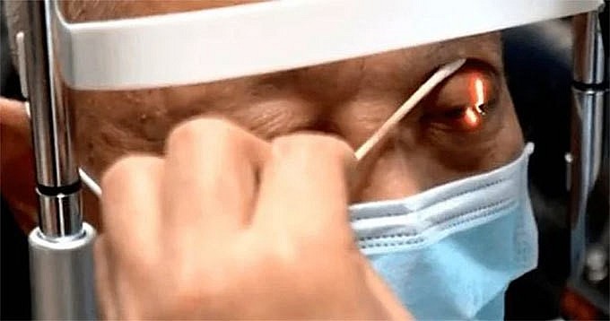 Bác sĩ kiểm tra mắt của ông Zhang ở Vũ Hán, Trung Quốc. Ảnh: ChinaImage Bác sĩ kiểm tra mắt của ông Zhang ở Vũ Hán, Trung Quốc. Ảnh: ChinaImage