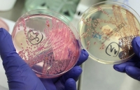 Mỹ bùng phát dịch E.coli