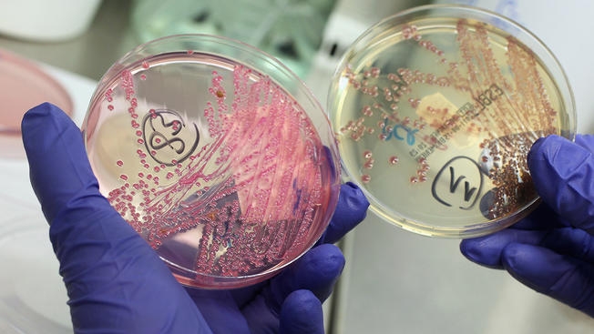 my bung phat dich ecoli