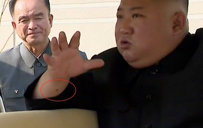co tay ong kim jong un xuat hien vet do bi an