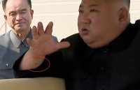 Cổ tay ông Kim Jong-un xuất hiện 'vết đỏ bí ẩn'