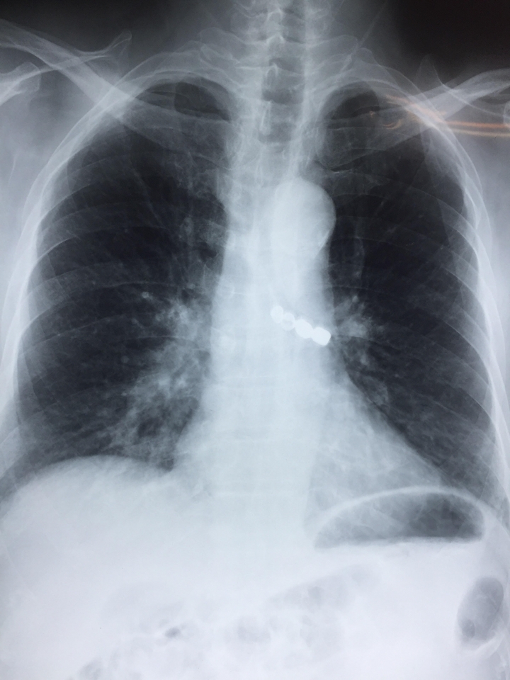 cuu song cu ong roi ca cau rang gia vao phe quan