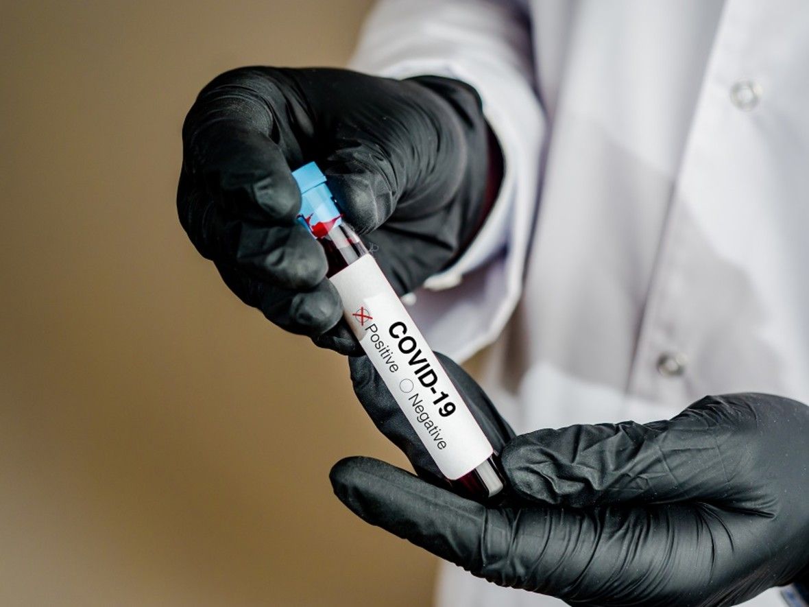 dich covid 19 o phap dinh dich co the dien ra trong 5 den 8 ngay toi