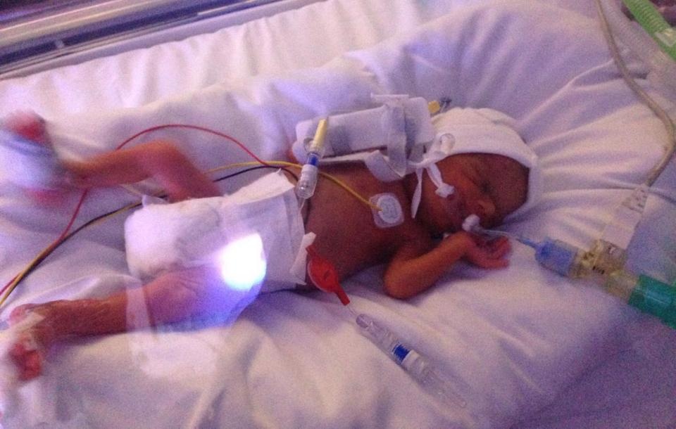 phep mau than ky cua nguoi chi giup be gai ton thuong nao phuc hoi