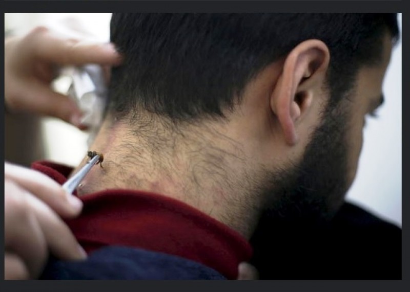 cho ong dot de chua benh