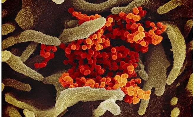 cap nhat 19h ngay 15 nhat ban an do thu nghiem thuoc chong covid 19 belarus so ca mac nhieu thu 2 o trung dong au lao noi long han che