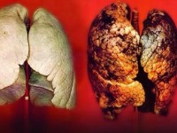 vi sao la phoi doi mau sau khi hut 60 dieu thuoc la