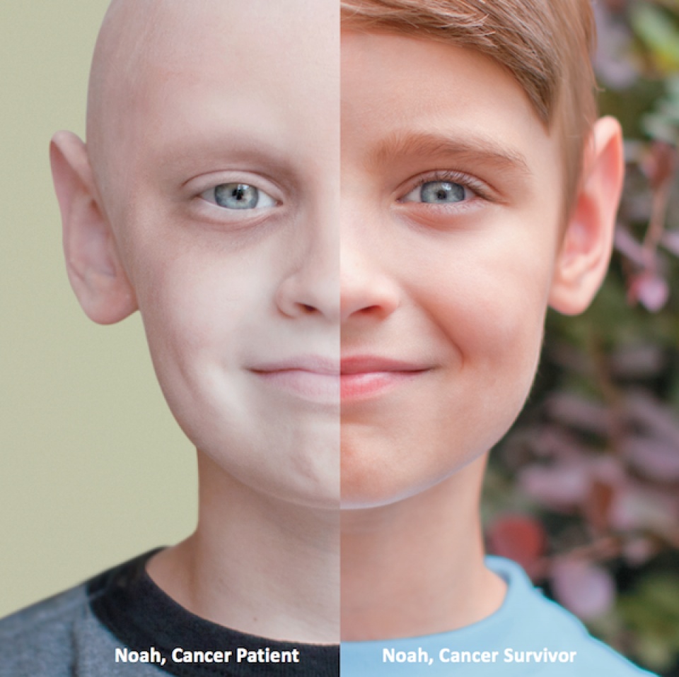 du bao ty le song them 10 nam sau khi co chan doan ung thu