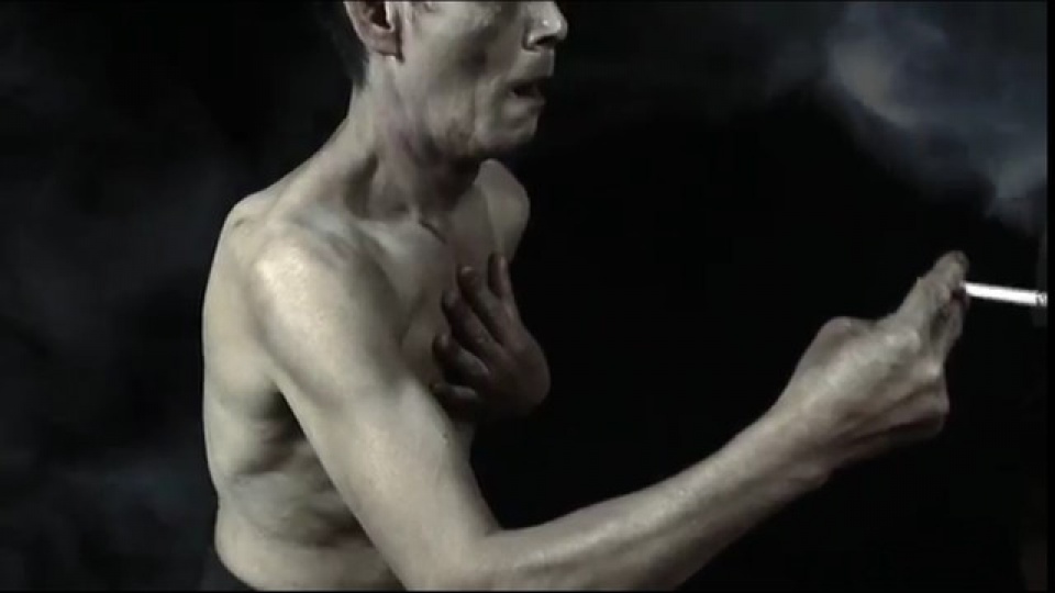 can benh minh thuan mac phai khien 17000 nguoi viet chet moi nam