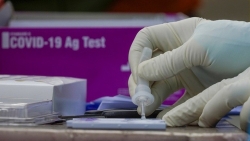 Bộ Y tế cho phép các test nhanh Covid-19 nào để xác định ca mắc?