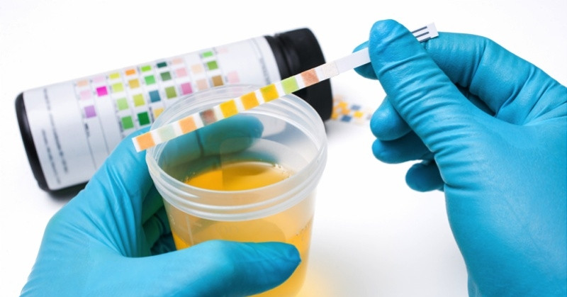 4 lý do bạn không nên bỏ qua xét nghiệm nước tiểu khi khám sức khỏe 4 lý do bạn không nên bỏ qua xét nghiệm nước tiểu khi khám sức khỏe