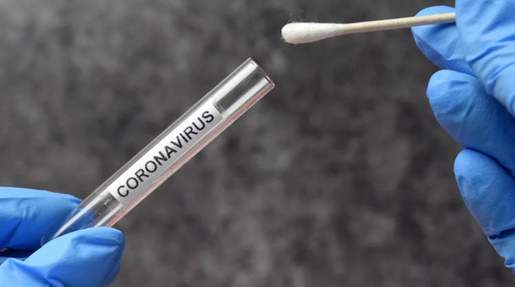 Hậu quả để lại sau khi mắc Covid-19 là gì?