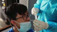 Covid-19 ở Hà Nội: Số mắc mới giảm hơn 100 ca, chỉ còn hơn 131.000 F0 đang điều trị