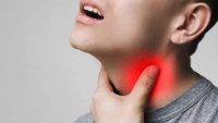 Biểu hiện đau họng ở bệnh nhân nhiễm Covid-19