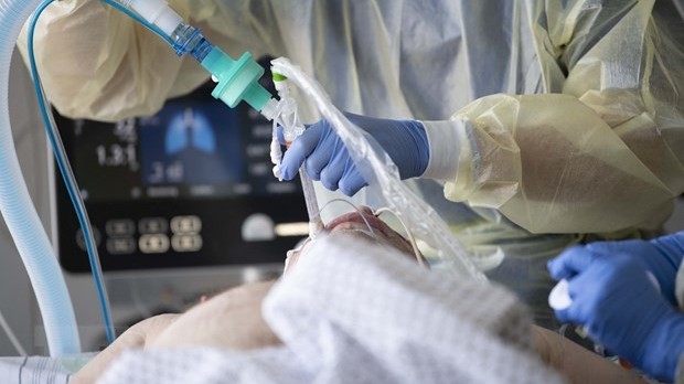 vi sao nhieu nguoi mac covid19 nang hon nguoi khac