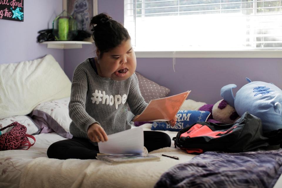 nghi luc phi thuong cua co gai deo khoi u khong lo tren mat 16 nam van mo lam y ta