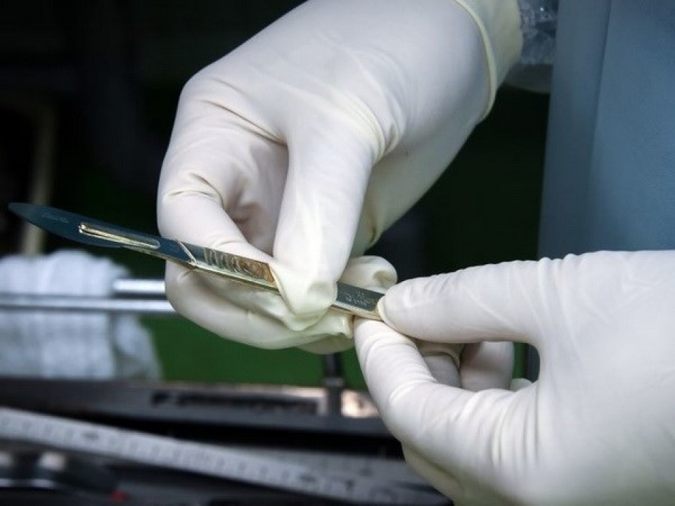 hy huu bac sy thao bo qua than cua benh nhan vi nham tuong la khoi u