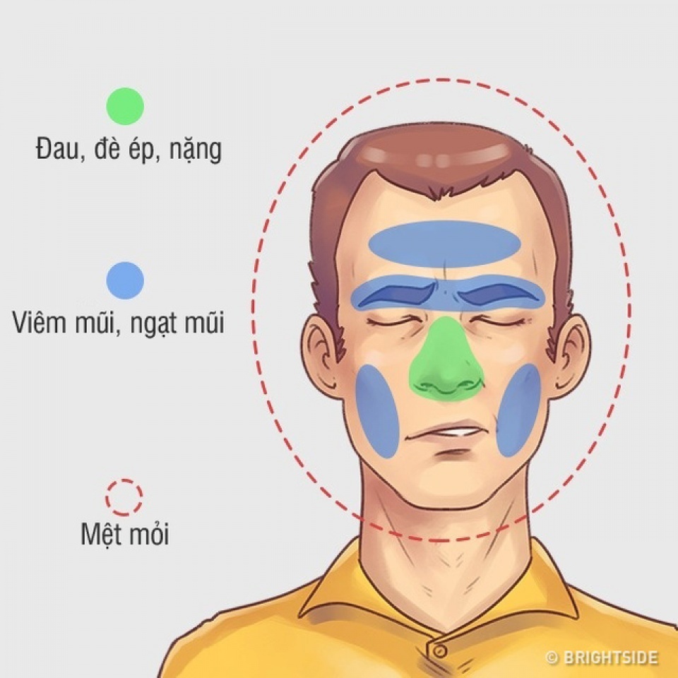 bi quyet tri hieu qua 5 kieu dau dau hay gap