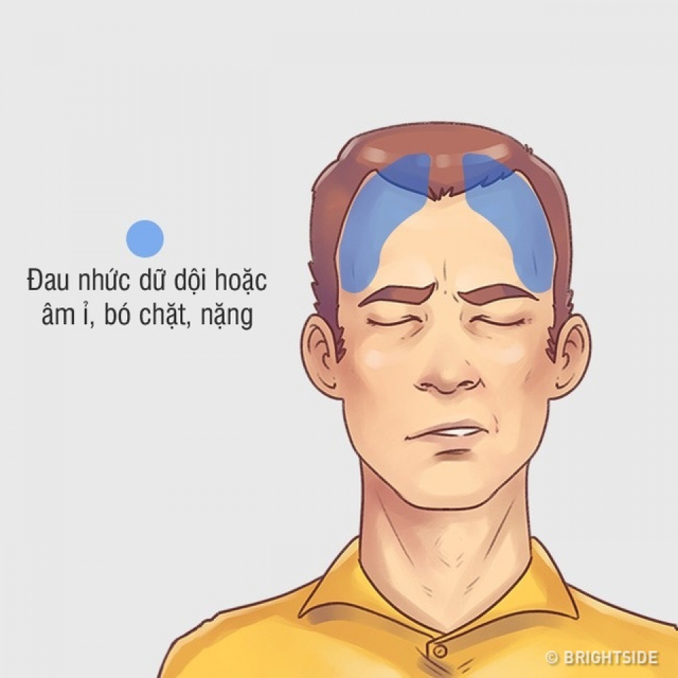 bi quyet tri hieu qua 5 kieu dau dau hay gap