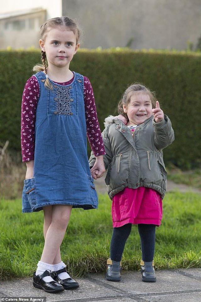 be 4 tuoi mac benh sieu hiem ca the gioi chi co 30 nguoi