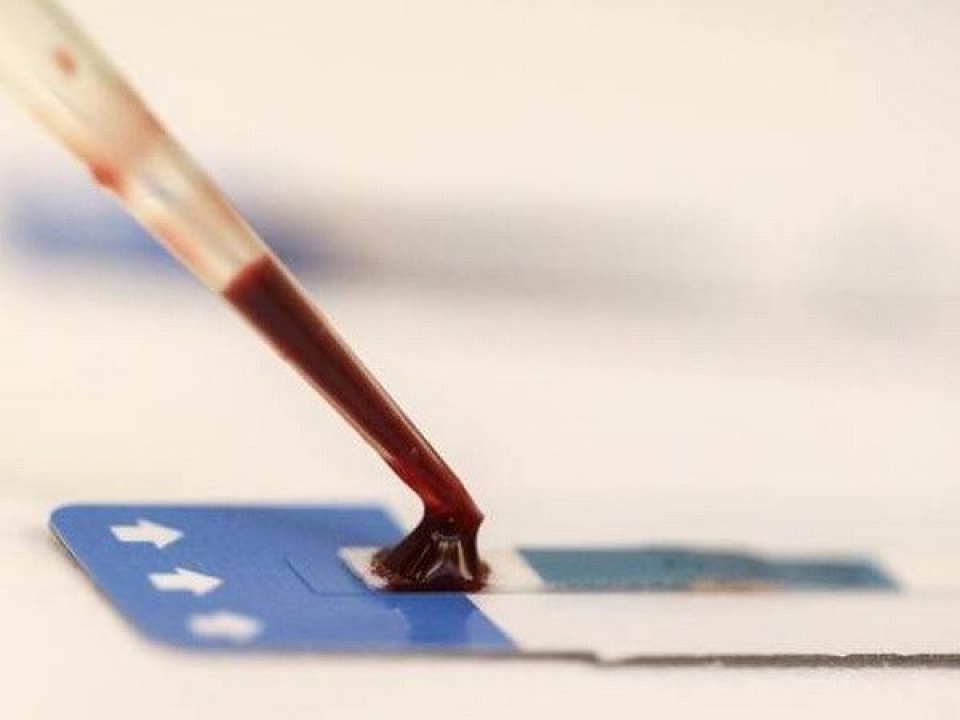 phat trien phuong phap chan doan nhanh va dieu tri benh lao phoi