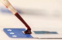 Phát triển phương pháp chẩn đoán nhanh và điều trị bệnh lao phổi