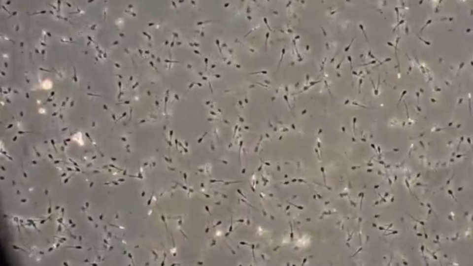 thu tinh thanh cong 34 con cuu tu tinh dich dong lanh lau doi nhat the gioi