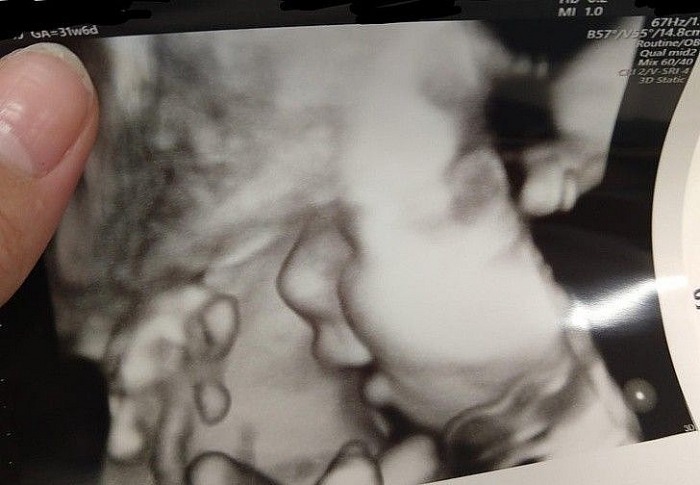 khoanh khac tinh yeu luon o quanh ta