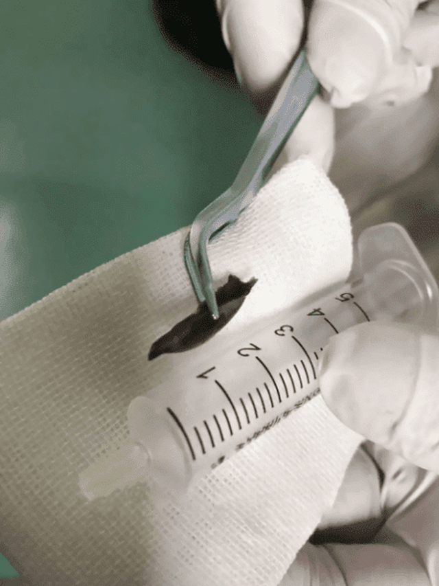 chuyen la ho dai dang 14 nam vi hoc xuong