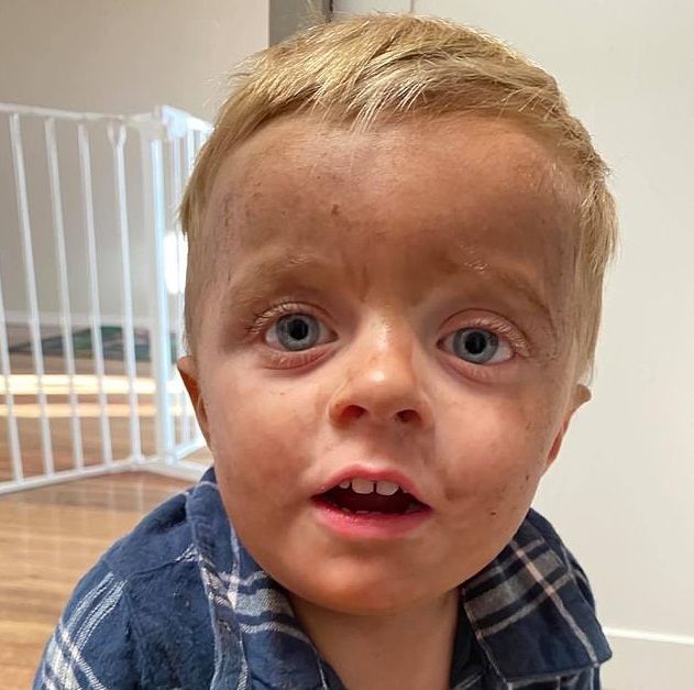 cau be mang lan da nhem nhuoc vi nham thuoc nhuom da voi xa phong