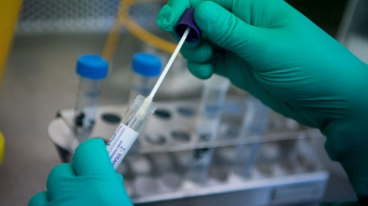 covid19 ngay 86 913 ca mac moi 8363 ca khoi benh va con 78 truong hop f0 nang