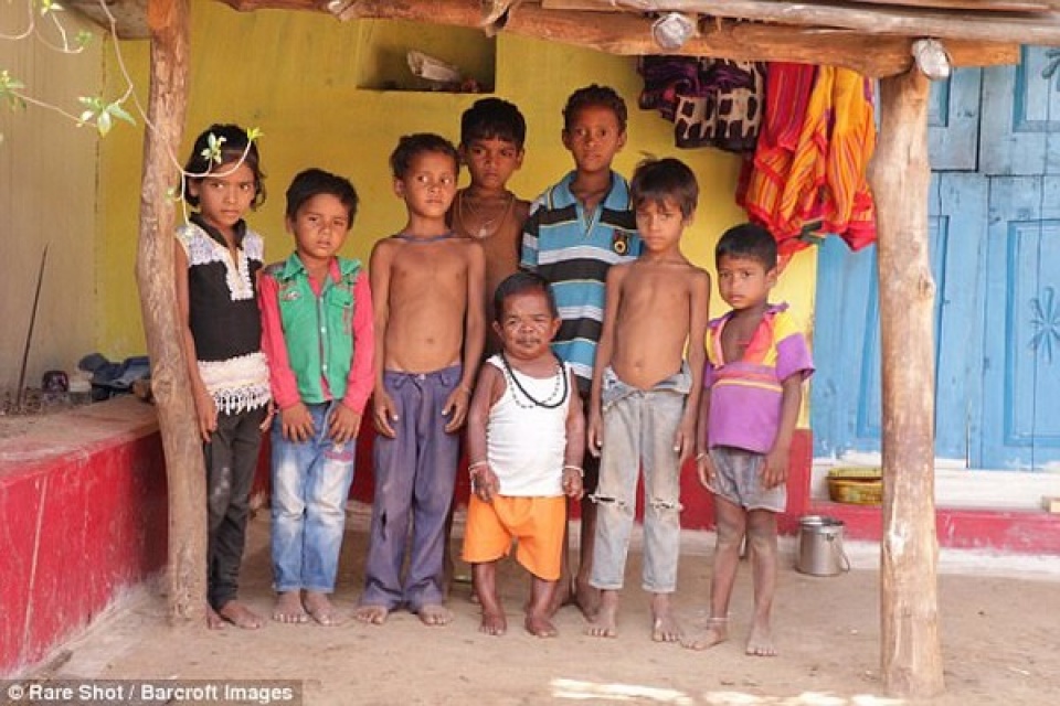 Người đàn ông 50 tuổi trong hình hài đứa trẻ cao 73cm nguoi dan ong 50 tuoi trong hinh hai dua tre cao 73cm