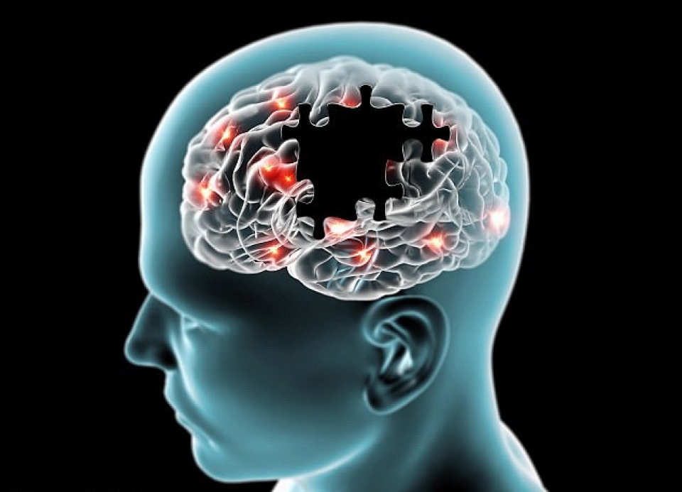 nghien cuu moi phat hien nguon goc bien doi te bao o benh alzheimer