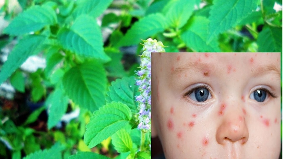 khi tre bi thuy dau can kieng nhung gi