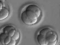 tim ra phuong phap phau thuat tren dna chinh sua cac gene bi loi