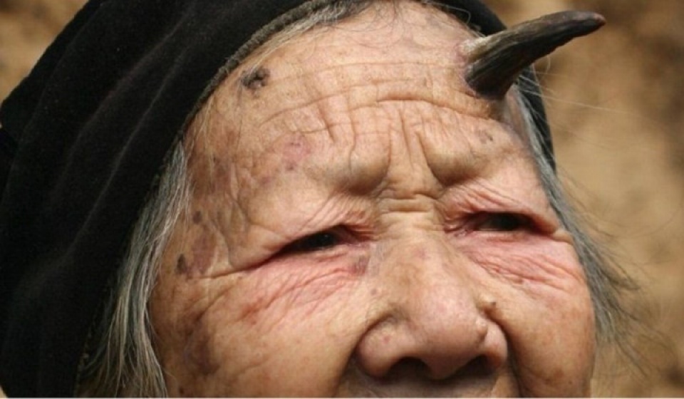 nhung nguoi co kha nang dac biet nhat the gioi